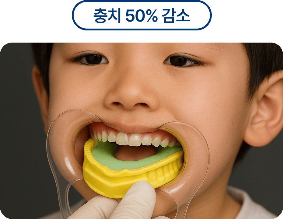 불소도포