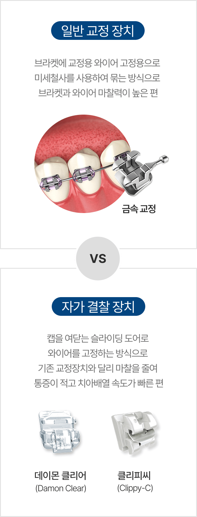 일반교정장치와 자가결찰장치의 차이