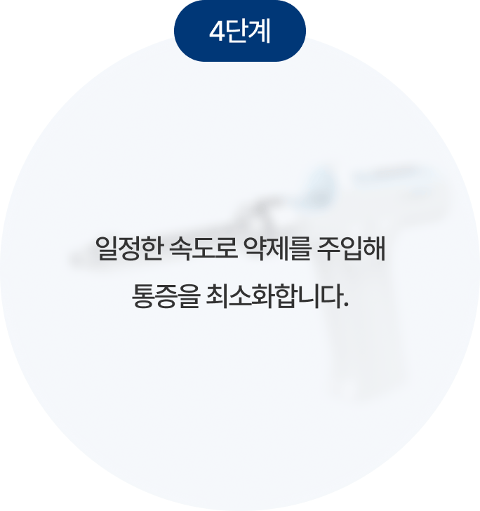 무통마취
